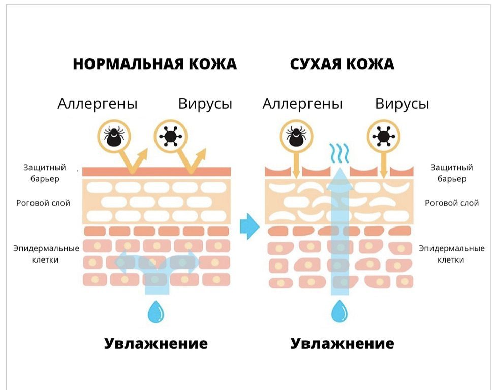 Сухая кожа. С чем это связано, и как за ней ухаживать